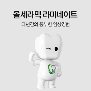 올세라믹 라미네이트